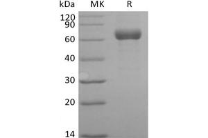 Western Blotting (WB) image for Angiopoietin-Like 3 (ANGPTL3) protein (Fc Tag) (ABIN7319869) (ANGPTL3 Protein (Fc Tag))