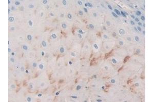 Immunohistochemistry (IHC) image for anti-Basal Cell Adhesion Molecule (Lutheran Blood Group) (BCAM) (AA 32-257) antibody (ABIN7442009)