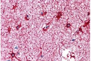 Human Brain, Cortex: Formalin-Fixed, Paraffin-Embedded (FFPE) (GFAP antibody)