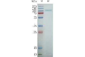 SDS-PAGE (SDS) image for Taste Receptor, Type 1, Member 2 (TAS1R2) protein (ABIN7538544)