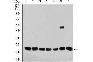 Western Blotting (WB) image for anti-Selenoprotein S (SELS) (AA 1-187) antibody (ABIN5935291) (Selenoprotein S antibody  (AA 1-187))