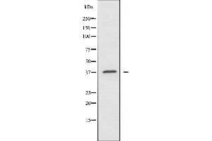 Western blot analysis of extracts from COLO205 cells using Caper antibody. (ATP6AP2 antibody  (Internal Region))