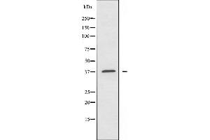 ATP6AP2 antibody  (Internal Region)