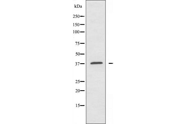 ATP6AP2 antibody  (Internal Region)