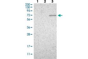 Western blot analysis of Lane 1: Human cell line RT-4 Lane 2: Human cell line U-251MG sp Lane 3: Human plasma (IgG/HSA depleted)  with ZNF37A polyclonal antibody  at 1:100-1:250 dilution. (ZNF37A antibody)