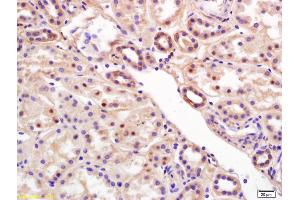 Formalin-fixed and paraffin embedded human kidney labeled with Rabbit Anti RCL/c Myc responsive Polyclonal Antibody, Unconjugated (ABIN872485) at 1:200 followed by conjugation to the secondary antibody and DAB staining (RCL antibody  (AA 101-174))
