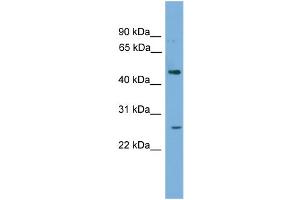 WB Suggested Anti-HLX Antibody Titration: 0. (HLX antibody  (Middle Region))