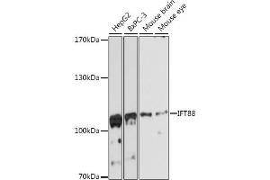 Western blot analysis of extracts of various cell lines, using IFT88 antibody (ABIN6131798, ABIN6142226, ABIN6142227 and ABIN6216899) at 1:3000 dilution. (IFT88 antibody  (AA 534-833))