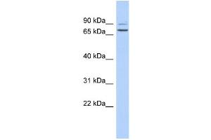 WB Suggested Anti-C9orf75 Antibody Titration: 0. (TPRN antibody  (Middle Region))