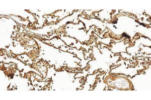 IHC analysis of RAGE/AGER using anti-RAGE/AGER antibody (ABIN7601722). (RAGE antibody  (AA 43-404))