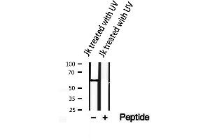 Western blot analysis of extracts from JK treated with UV, using Phospho-AKT1/2/3(Tyr315/316/312) Antibody. (AKT 1/2/3 antibody  (pTyr312, pTyr315, pTyr316))