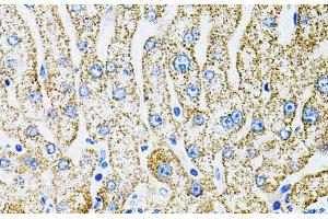Immunohistochemistry (Paraffin-embedded Sections) (IHC (p)) image for anti-Erythropoietin (EPO) antibody (ABIN7261612)