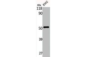 Western Blot analysis of K562 cells using eIF2Bγ Polyclonal Antibody (EIF2B3 antibody  (Internal Region))