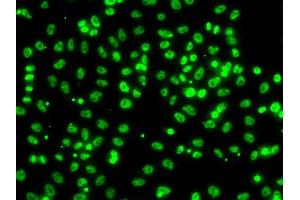 Immunofluorescence analysis of A549 cells using CSRNP1 antibody (ABIN5974288). (AXUD1 antibody)