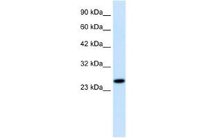 RGS13 antibody used at 1. (RGS13 antibody  (Middle Region))