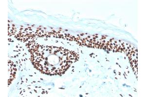 Immunohistochemistry (IHC) image for anti-Nucleophosmin (Nucleolar phosphoprotein B23, Numatrin) (NPM1) (AA 185-287) antibody (ABIN6940222)
