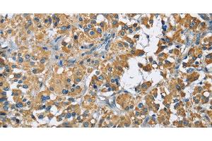 ZMYND11 antibody