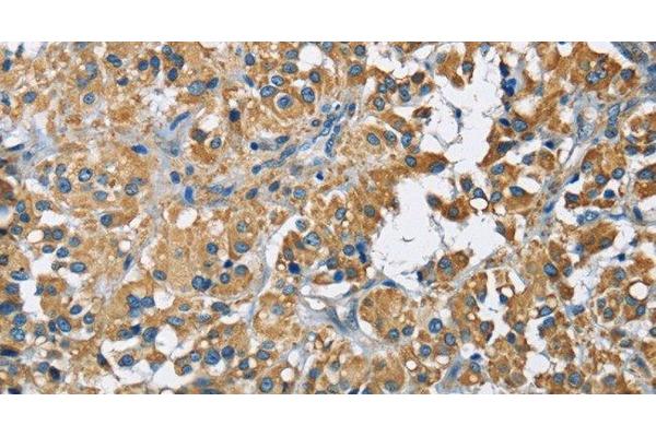 ZMYND11 antibody