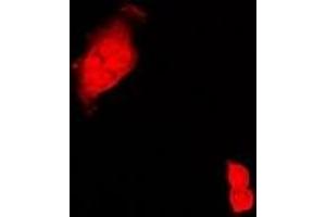 Immunofluorescent analysis of CIRBP staining in Hela cells. (CIRBP antibody)