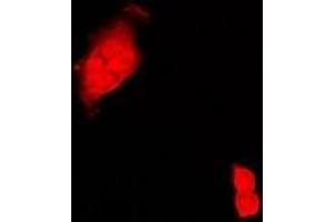 Immunofluorescent analysis of CIRBP staining in Hela cells. (CIRBP antibody)