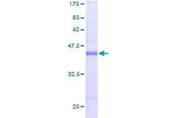 CHRAC1 Protein (AA 1-131) (GST tag)