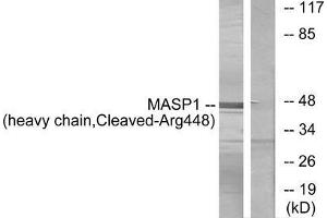 Western blot analysis of extracts from A549 cells, treated with etoposide (25uM, 24hours), using MASP1 (heavy chain, Cleaved-Arg448) antibody. (MASP1 antibody  (Cleaved-Arg448))