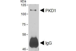 HEK293 lysate overexpressing Human DYKDDDDK-tagged PKD1 was used to immunoprecipitate PKD1 with 2ug ABIN5539576. (PKC mu antibody  (AA 383-395))