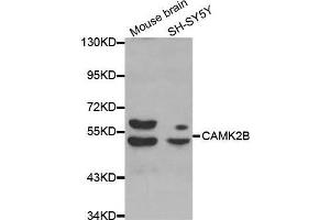 Western blot analysis of extracts of various cell lines, using CAMK2B antibody. (CAMK2B antibody  (AA 1-300))