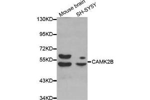 Western blot analysis of extracts of various cell lines, using CAMK2B antibody.