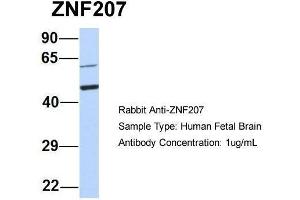 Host:  Rabbit  Target Name:  ZNF207  Sample Type:  Human Fetal Brain  Antibody Dilution:  1. (ZNF207 antibody  (Middle Region))