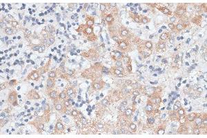 Immunohistochemistry of paraffin-embedded Human liver using GPC4 Polyclonal Antibody at dilution of 1:100 (40x lens). (GPC4 antibody)
