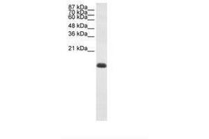 Image no. 2 for anti-Zinc Finger Protein 786 (ZNF786) (N-Term) antibody (ABIN203008)