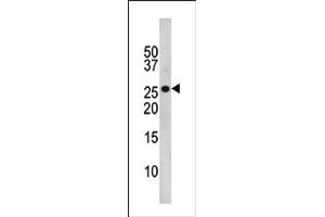 Image no. 1 for anti-Cyclin-Dependent Kinase Inhibitor 1B (p27, Kip1) (CDKN1B) (pThr157) antibody (ABIN358185)