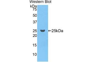 Western blot analysis of the recombinant protein. (Coagulation Factor IX antibody  (AA 61-263))