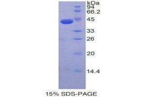 SDS-PAGE (SDS) image for Natriuretic Peptide A (NPPA) protein (ABIN1078936) (NPPA Protein)