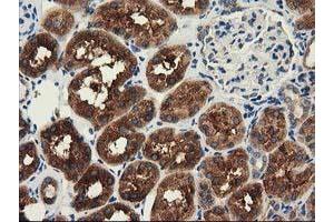Immunohistochemical staining of paraffin-embedded Human Kidney tissue using anti-HDAC6 mouse monoclonal antibody. (HDAC6 antibody)