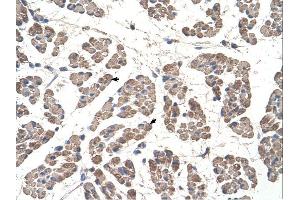 GCDH antibody was used for immunohistochemistry at a concentration of 4-8 ug/ml. (GCDH antibody  (C-Term))