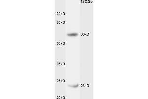 Rat liver lysates probed with Rabbit Anti-CPT1B Polyclonal Antibody (ABIN708851) at 1:200 in 4 °C.