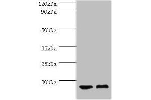 Western blot All lanes: COTL1 antibody at 5 μg/mL Lane 1: Mouse brain tissue Lane 2: Mouse kidney tissue Secondary Goat polyclonal to rabbit IgG at 1/10000 dilution Predicted band size: 16 kDa Observed band size: 16 kDa (COTL1 antibody  (AA 1-142))