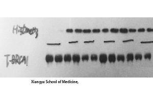 Western Blot (WB) analysis: Please contact us for more details. (BRCA1 antibody  (Ser183))