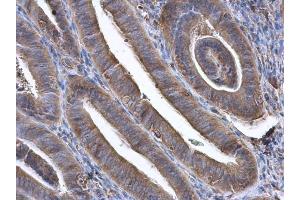 IHC-P Image GBP3 antibody [N1C1] detects GBP3 protein at cytoplasm in human endometrium by immunohistochemical analysis.