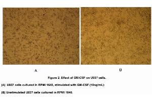 Cell differentiation of U937 cells after incubation with GM-CSF (10ng/mL) for 5 days was shown in Figure 2. (GM-CSF Protein (AA 18-144) (His tag))