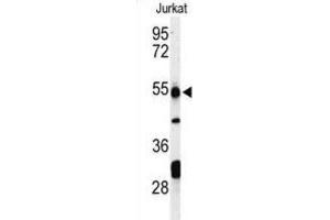 Western Blotting (WB) image for anti-Prune Exopolyphosphatase (PRUNE) antibody (ABIN3004302) (PRUNE antibody)