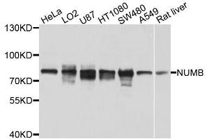 Western blot analysis of extracts of various cell lines, using NUMB antibody (ABIN5996190) at 1/1000 dilution. (NUMB antibody)