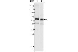 Western blot analysis using AFP mouse mAb against HepG2 (1) and SMMC-7721 (2) cell lysate.