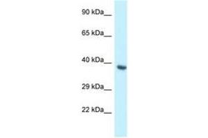 Image no. 1 for anti-BCL2-Like 12 (Proline Rich) (BCL2L12) (AA 165-214) antibody (ABIN6747456) (BCL2L12 antibody  (AA 165-214))