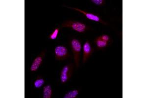 Immunofluorescence (IF) image for anti-Small Ubiquitin Related Modifier 2 (SUMO2) (AA 1-93), (N-Term) antibody (ABIN492386) (SUMO2 antibody  (N-Term))