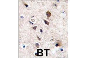 Formalin-fixed and paraffin-embedded human brain tissue reacted with PKC gamma antibody (C-term), which was peroxidase-conjugated to the secondary antibody, followed by DAB staining. (PKC gamma antibody  (C-Term))