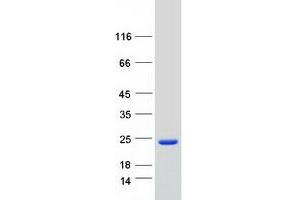 Validation with Western Blot