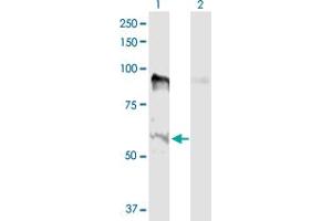 Western Blot analysis of MSL2 expression in transfected 293T cell line by MSL2 MaxPab polyclonal antibody. (MSL2 antibody  (AA 1-577))
